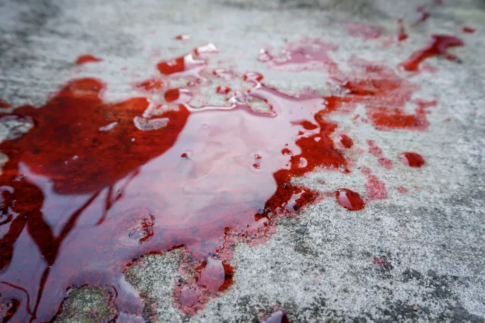 Vomiting Blood: Causes, Symptoms, And Treatment Options